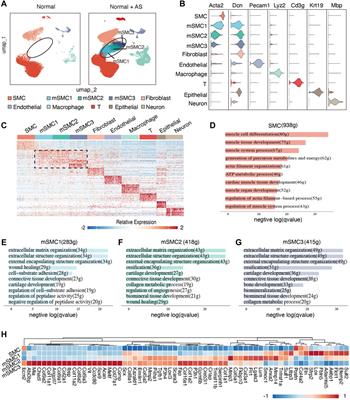 Revealing the Critical Regulators of Modulated Smooth Muscle Cells in Atherosclerosis in Mice